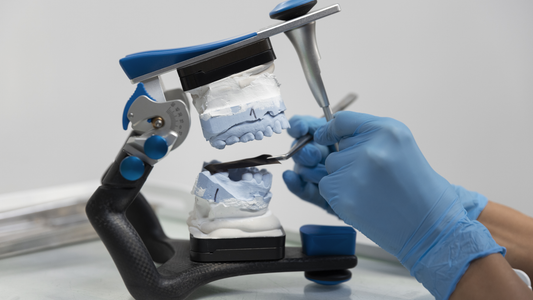 Migliori Materiali per Impronte Dentali