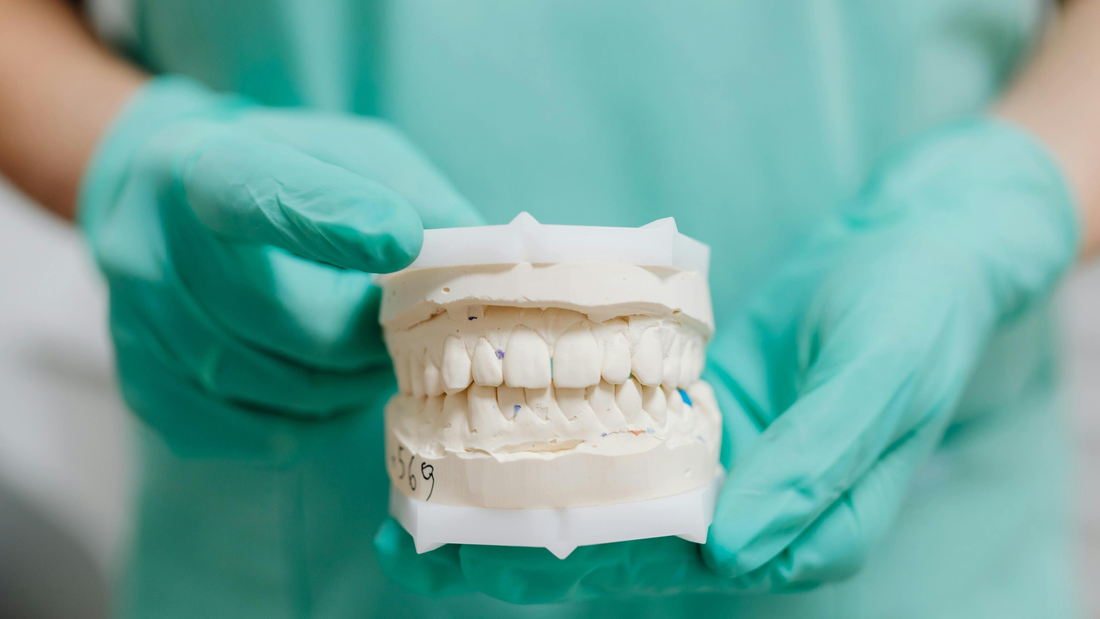 Gesso odontotecnico di tipo IV utilizzato per modelli di protesi fissa