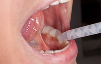 REGOFIX TRANSAPENT - 2 x 50 ml double cartridges